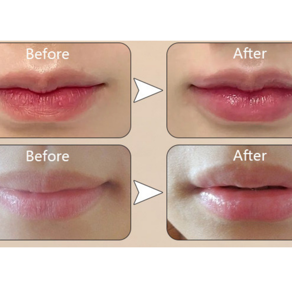 
                      
                        lip enhancement - beauty product
                      
                    